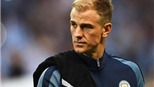 Pep Guardiola: ‘Vị trí thủ môn thứ hai cũng không được đảm bảo cho Joe Hart’